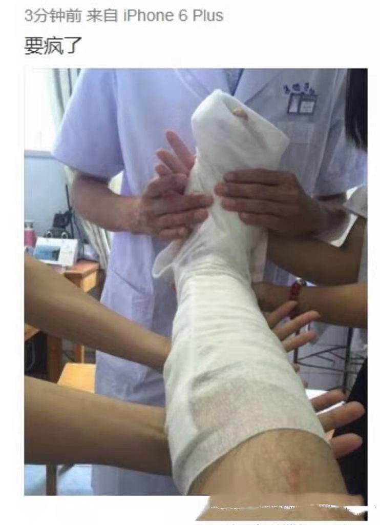 于朦胧拍戏再受伤曾经拍戏因为威亚老师失误导致他腿摔骨折