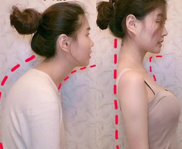 孩子喜欢含胸驼背不仅影响身体发育还可能会影响身心健康