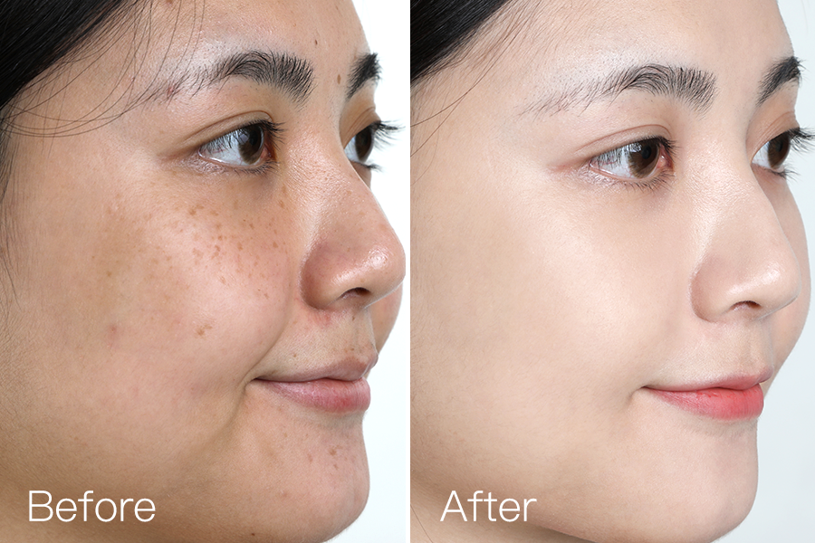 优质的樱花精华,只需使用一次,就能让熬夜色斑脸,快速恢复白皙光彩!