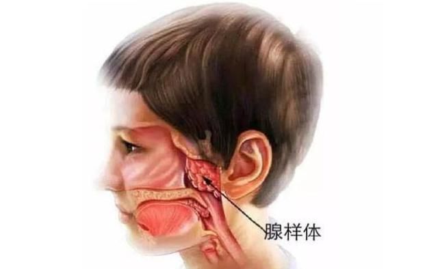 让孩子不长个变丑|陈洁|腺样体肥大|腺样体_新浪新闻