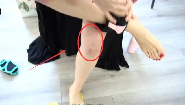 浪姐2王鸥为了舞蹈动作跳得更好腿上全是淤青让人心疼