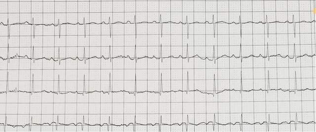从妈妈腹中到保温箱,宝宝心跳一路超速!还好有白衣天使在身边休闲区蓝鸢梦想 - Www.slyday.coM 从妈妈腹中到保温箱,宝宝心跳一路超速!还好有白衣天使在身边休闲区蓝鸢梦想 - Www.slyday.coM