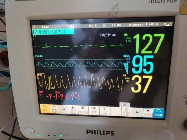 从妈妈腹中到保温箱,宝宝心跳一路超速!还好有白衣天使在身边休闲区蓝鸢梦想 - Www.slyday.coM 从妈妈腹中到保温箱,宝宝心跳一路超速!还好有白衣天使在身边休闲区蓝鸢梦想 - Www.slyday.coM