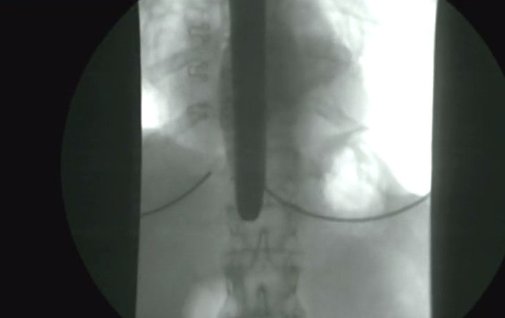 女子表演口中吞剑,用X光来实拍肚子情况,看到让人佩服!休闲区蓝鸢梦想 - Www.slyday.coM 女子表演口中吞剑,用X光来实拍肚子情况,看到让人佩服!休闲区蓝鸢梦想 - Www.slyday.coM