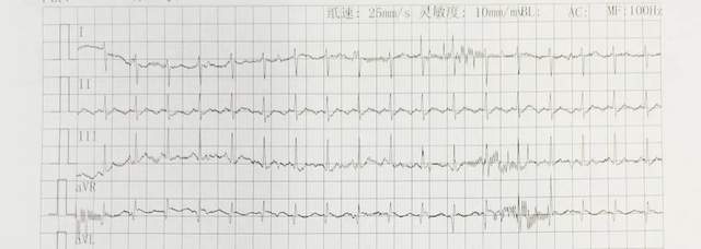 从妈妈腹中到保温箱,宝宝心跳一路超速!还好有白衣天使在身边休闲区蓝鸢梦想 - Www.slyday.coM 从妈妈腹中到保温箱,宝宝心跳一路超速!还好有白衣天使在身边休闲区蓝鸢梦想 - Www.slyday.coM