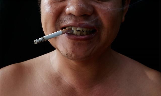 牙黄口气让最亲的人离他三米远鱼和熊掌如何兼得