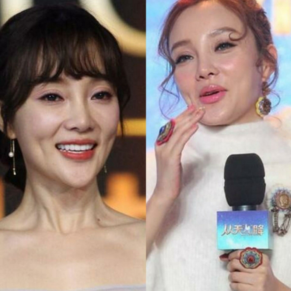 整容失败的女星她们原本天生丽质有人变成大妈有人堪比毁容