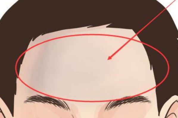 额头纹生有三字型额头纹的人,命里三才汇聚,福禄寿全,可以说是天生的