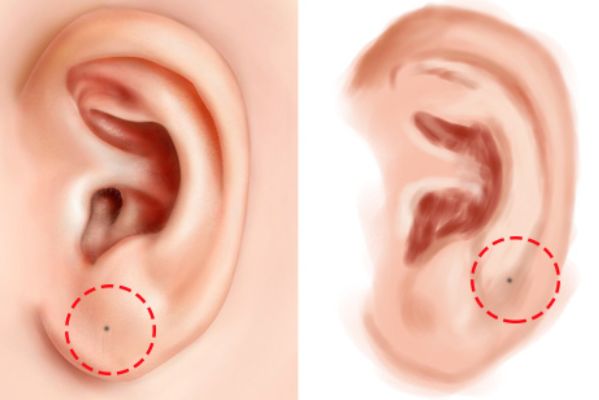 财富|耳朵|耳垂_新浪新闻