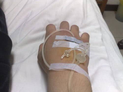 输液时空气不小心输进血管会怎样