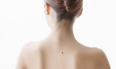 "有福之人痣背人,无福之人人背痣",这几颗痣富贵逼人,你有吗|脊柱|尾