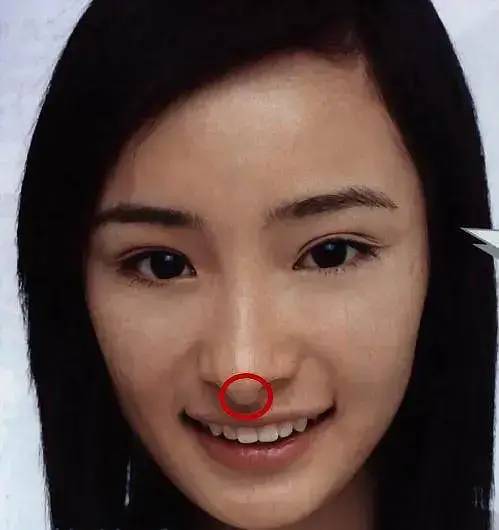 杨幂鼻孔变大原因早年鼻小柱明显不够秀气后鼻小柱消失鼻外翻