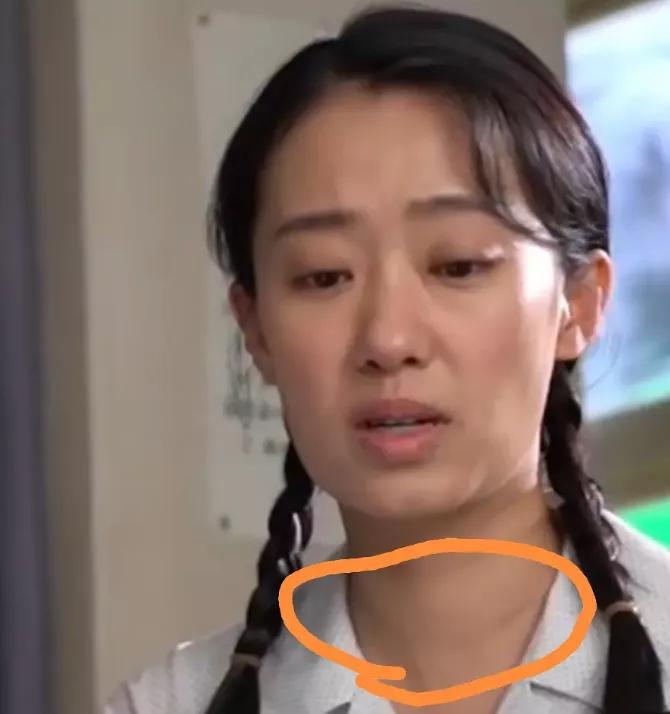 张小斐疑似患病?怼脸自拍曝光甲状腺肿大,网友似乎关心过头