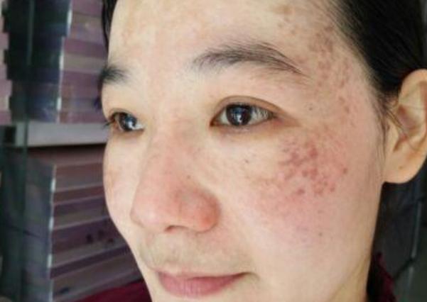 69岁老中医,脸上不见老年斑,大方分享秘诀:就在一日三餐里