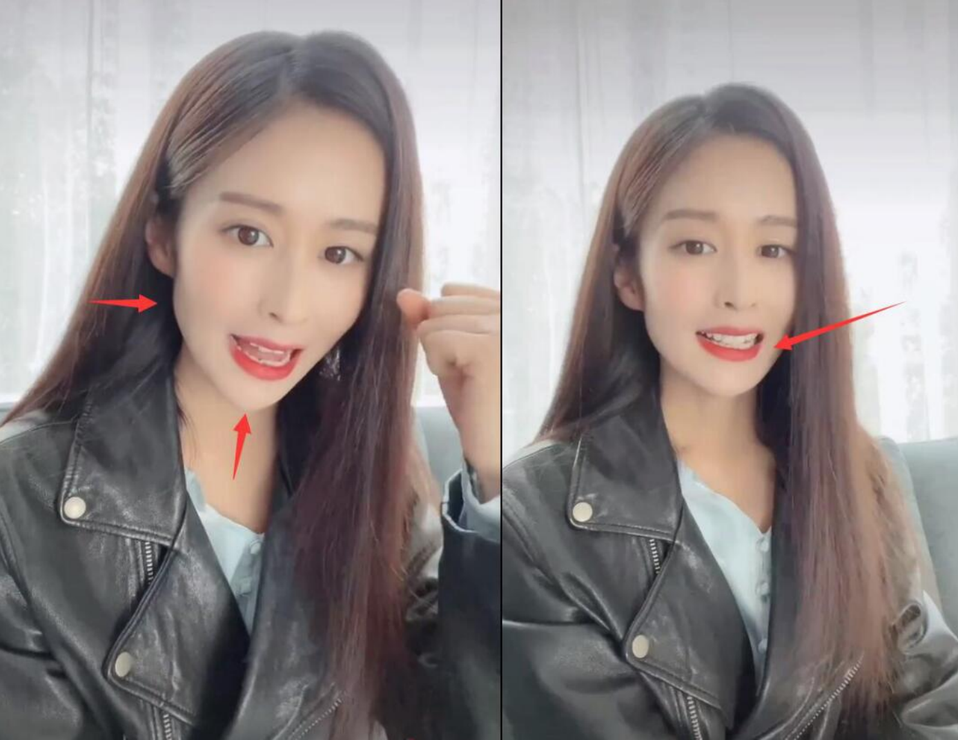 32岁颖儿说话嘴巴歪斜瘦脱相脸颊都凹陷房子大到说话都有回音