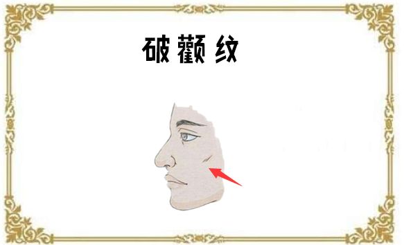 破颧纹所谓的破颧纹,是指长在颧骨处的乱纹,会破坏颧骨的面相.
