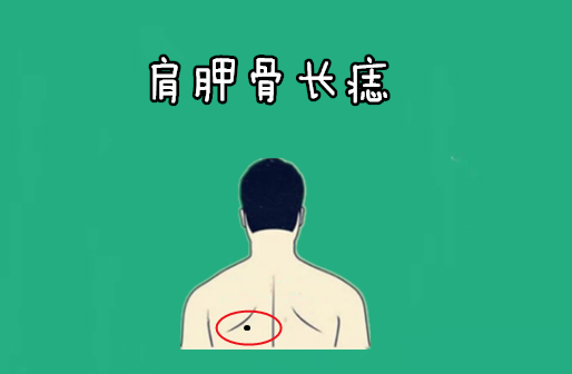 若是在肩胛骨的位置出长有吉痣,则被称之为"巨富"痣,大多数的情况下