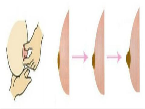 孕期乳头总有分泌物要紧吗?