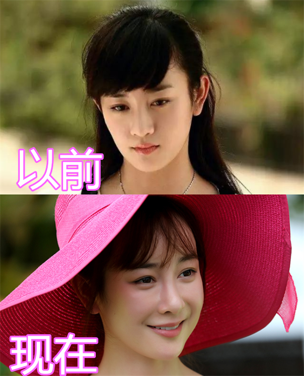 角色收成了许多观众们的稀饭,人气快上涨,只但是背面她却选定了整容