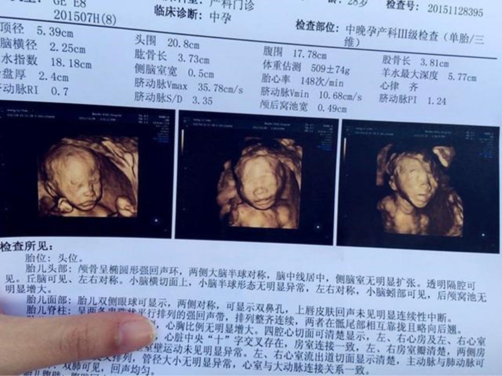 英国孕妇38周做彩超胎儿动作让准爸妈哭笑不得一看就是淘气包