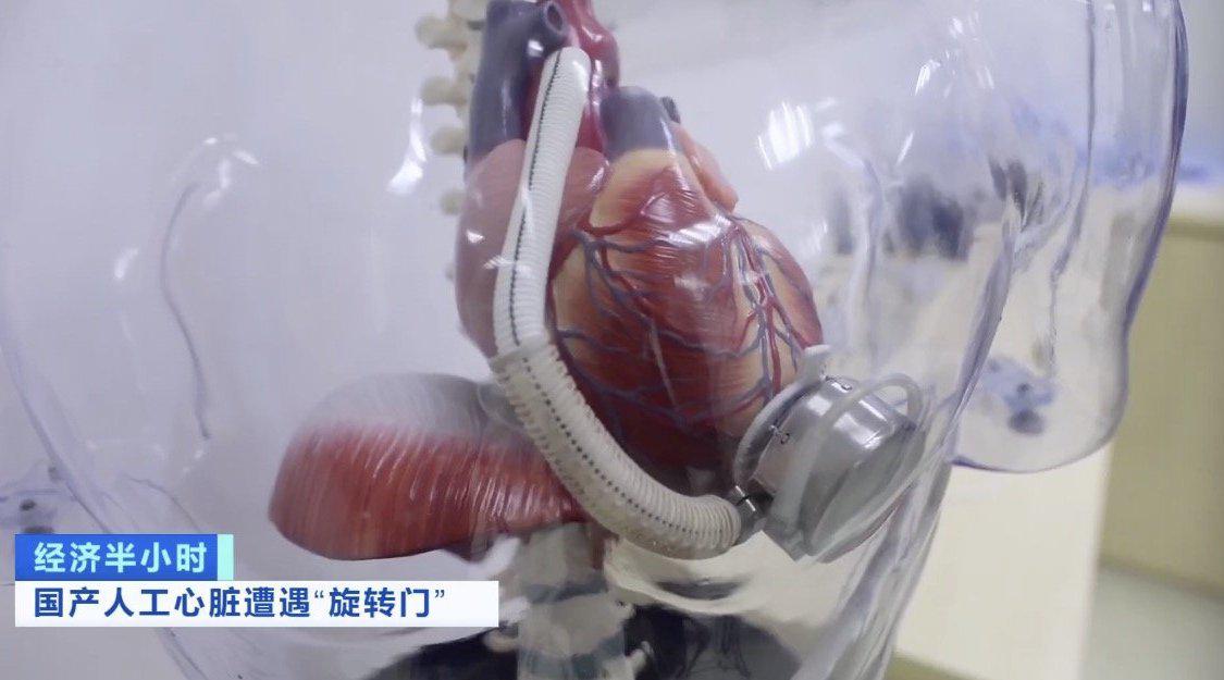 国产"人工心脏" 研发成功 五年时间,上万份材料换不来一纸上市批文