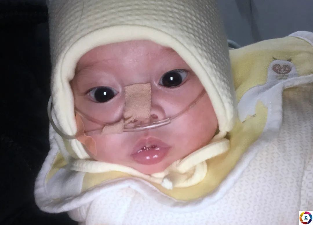 男婴刚出生就进icu8个月经历两次手术大眼睛让人过目难忘