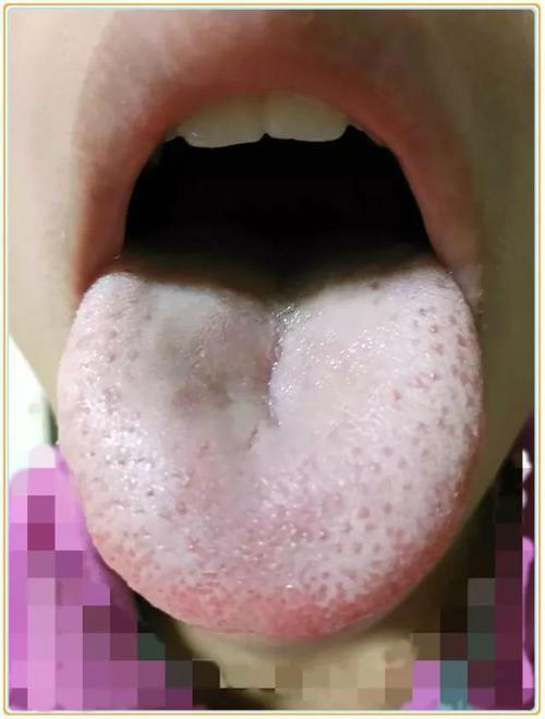 如何判断宝宝积食?4个表现"出卖"了你,食疗或许更有效