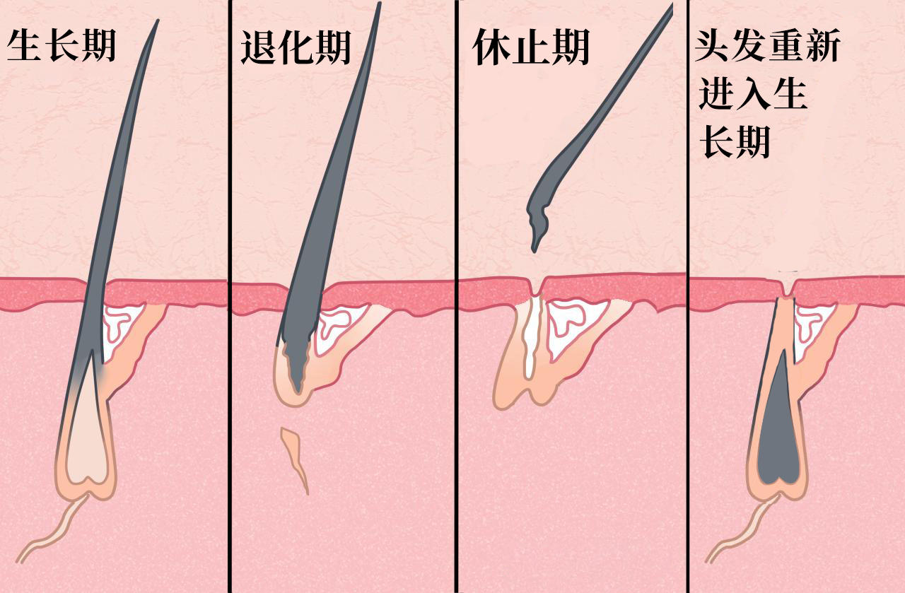 学会了吗（脱发后还能长头发吗?头发重新长出来需要多久时间）脱发后还能长头发吗?头发重新长出来需要多久才好，脱发后还能长头发吗？头发重新长出来需要多久？，戒色后头发会长出来吗女生，