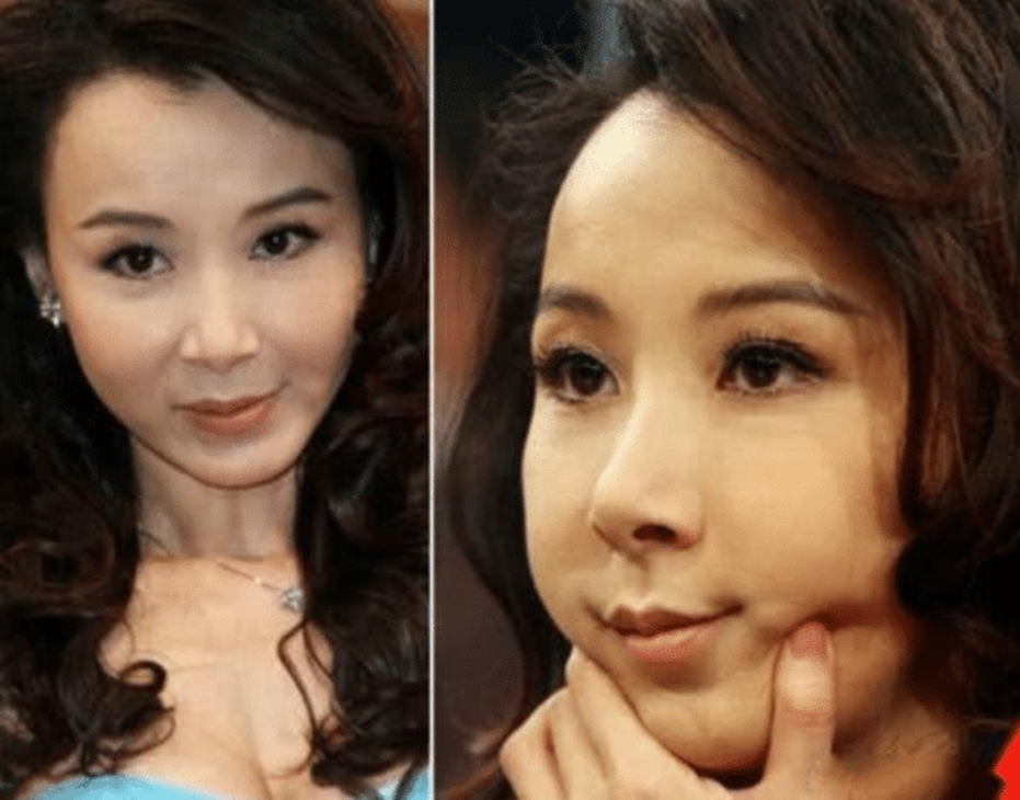 第一美女"的她现在已美人迟暮,但她却不肯服老,开始各种装嫩和整容