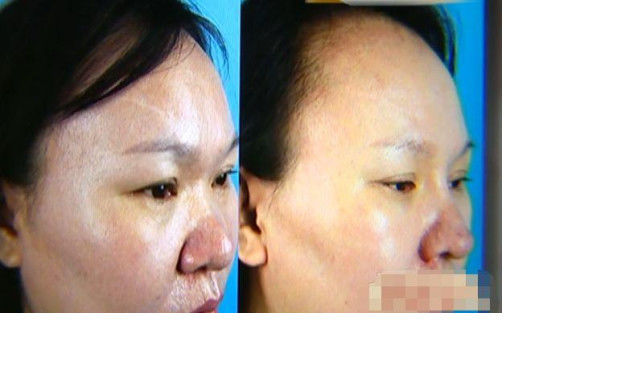 女子花3万整容,不料越整越难看,负责人:你的手术是成功的休闲区蓝鸢梦想 - Www.slyday.coM 女子花3万整容,不料越整越难看,负责人:你的手术是成功的休闲区蓝鸢梦想 - Www.slyday.coM