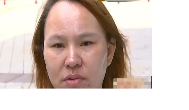 女子花3万整容,不料越整越难看,负责人:你的手术是成功的休闲区蓝鸢梦想 - Www.slyday.coM 女子花3万整容,不料越整越难看,负责人:你的手术是成功的休闲区蓝鸢梦想 - Www.slyday.coM