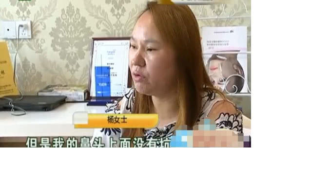 女子花3万整容,不料越整越难看,负责人:你的手术是成功的休闲区蓝鸢梦想 - Www.slyday.coM 女子花3万整容,不料越整越难看,负责人:你的手术是成功的休闲区蓝鸢梦想 - Www.slyday.coM