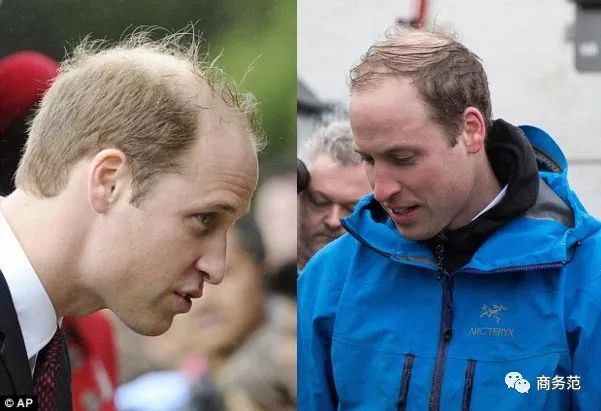 比如穿西装时,搭配一顶礼帽显得rio绅士;出席非正式场所时,一顶棒球帽