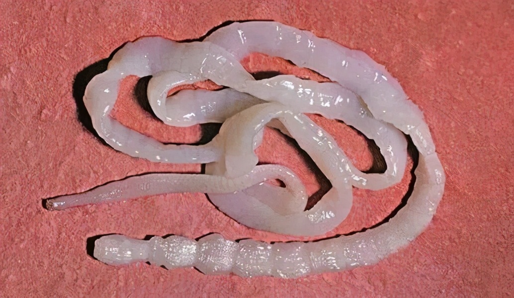 叫做牛带绦虫,人类是其唯一最终宿主,而中间宿主包括牛科动物,野山羊