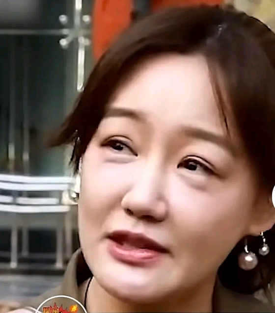 真的不要随便医美看没有生孩子的薛佳凝现在长啥样太苍老了