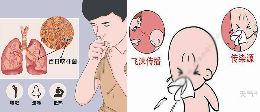 百日咳|咳嗽|症状_新浪新闻