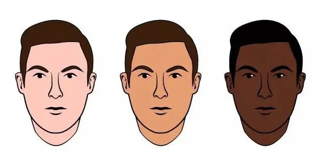 杭州激光祛斑治疗为什么有人会反黑