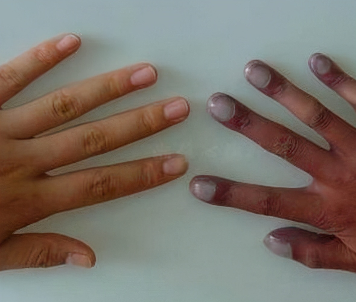 肺不好的人,多吃三白,远离三气,做好五件事,肺部越来越健康