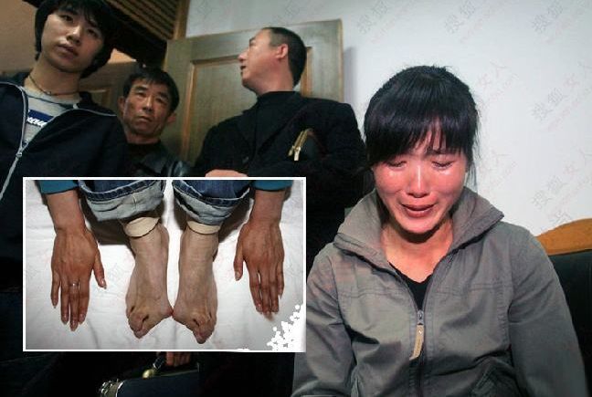拒绝给她分配工作,工作没找落,郭萍脚趾的病情却日渐严重