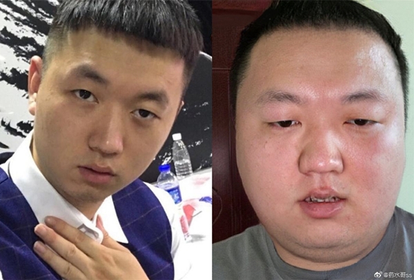 网红药水哥发福严重!自拍照宛如发面馒头,网友建议改名叫注水哥