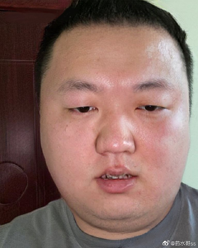 自拍照宛如发面馒头,网友建议改名叫注水哥|药水|发面|注水_新浪新闻