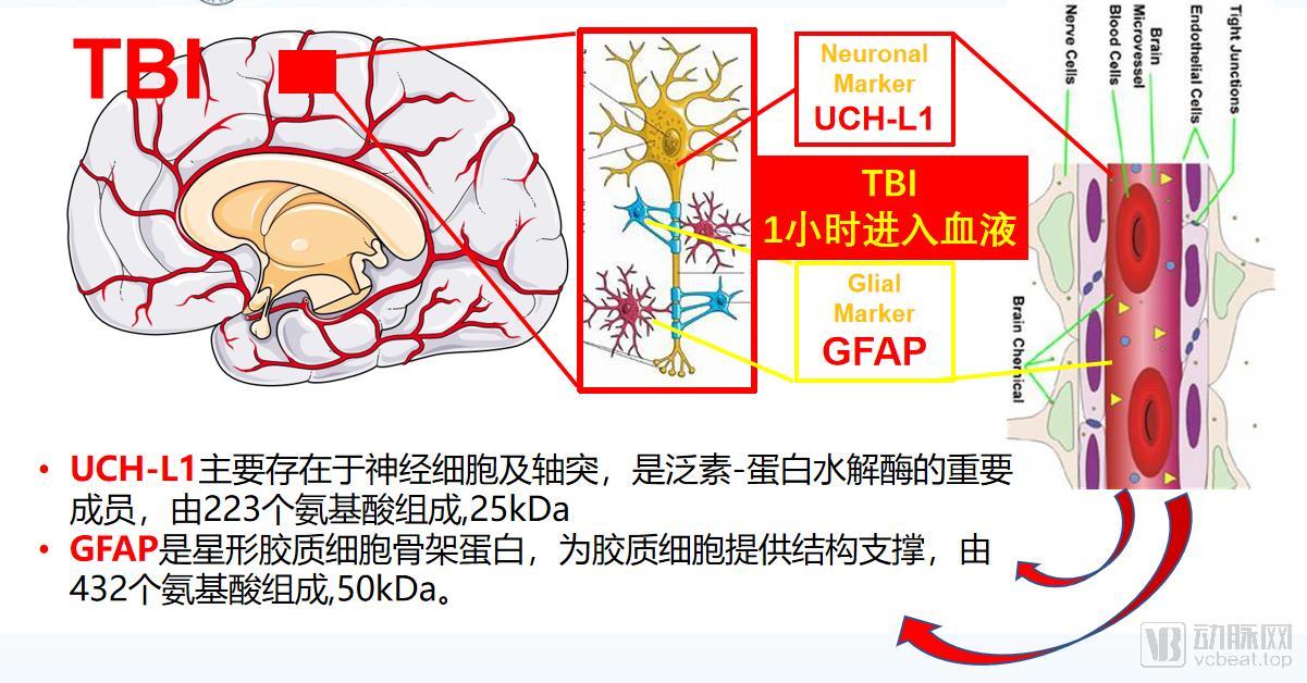 国内首个创伤性脑损伤血清学检测试剂盒获批,TBI诊断进入新时代|脑损伤|泰科|试剂盒_新浪新闻