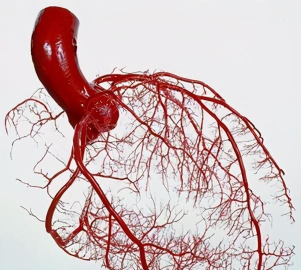 40岁男性胸闷半年心脏造影没事却突发急性心梗医生来解读