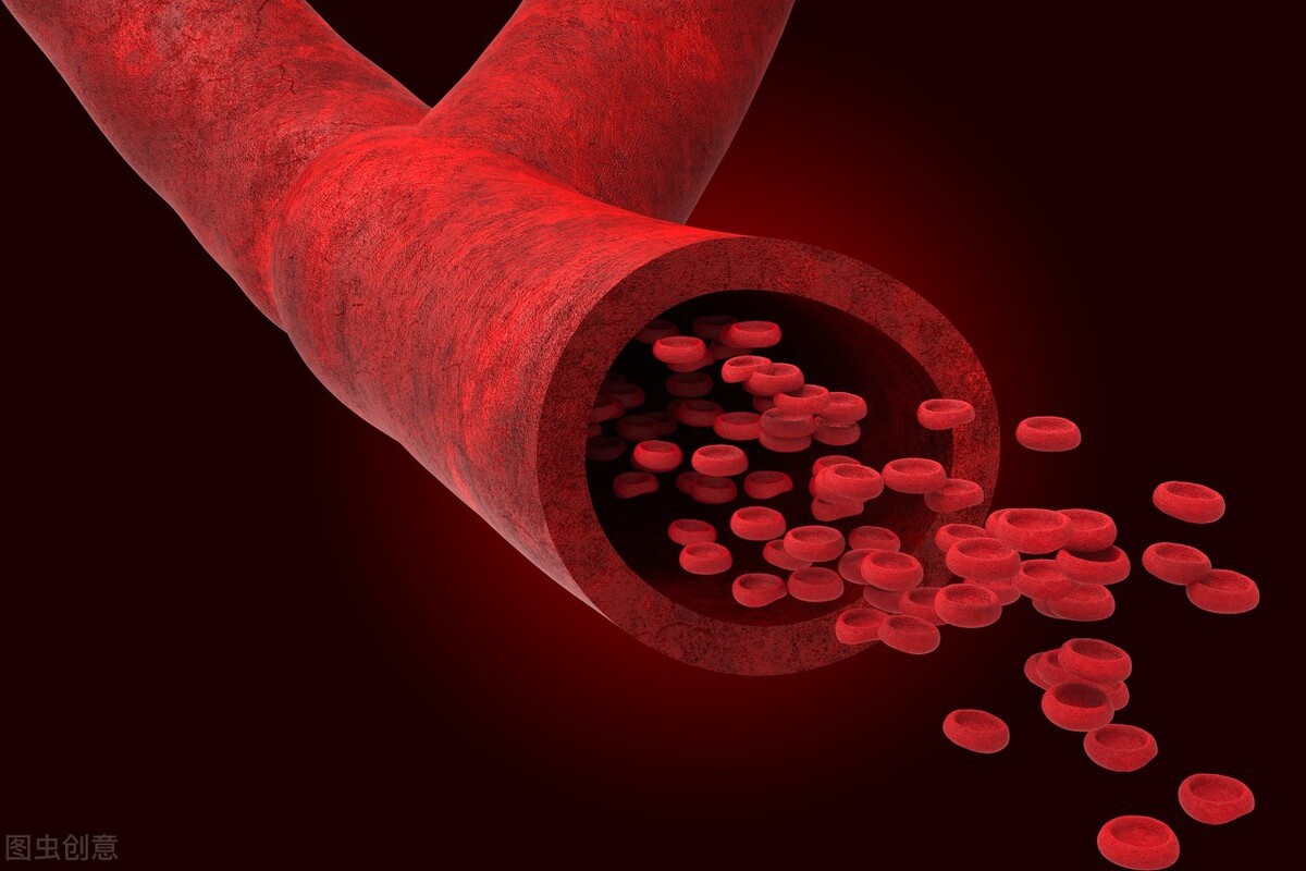 血液黏稠的人建议少食2鱼或能避免血管堵塞不妨了解一下