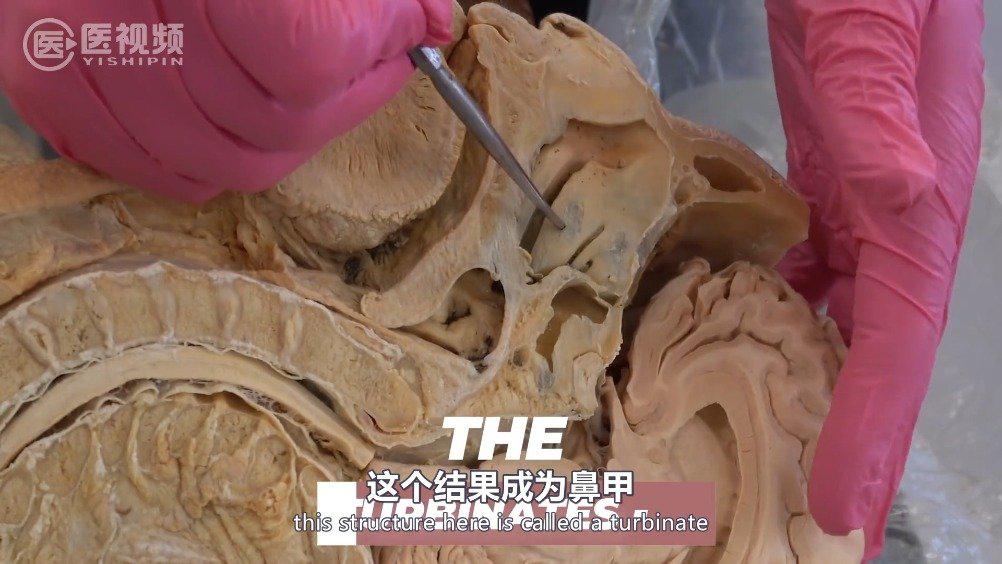 医学双语科普:从解剖学角度讲解新冠病毒鼻咽拭子的采集