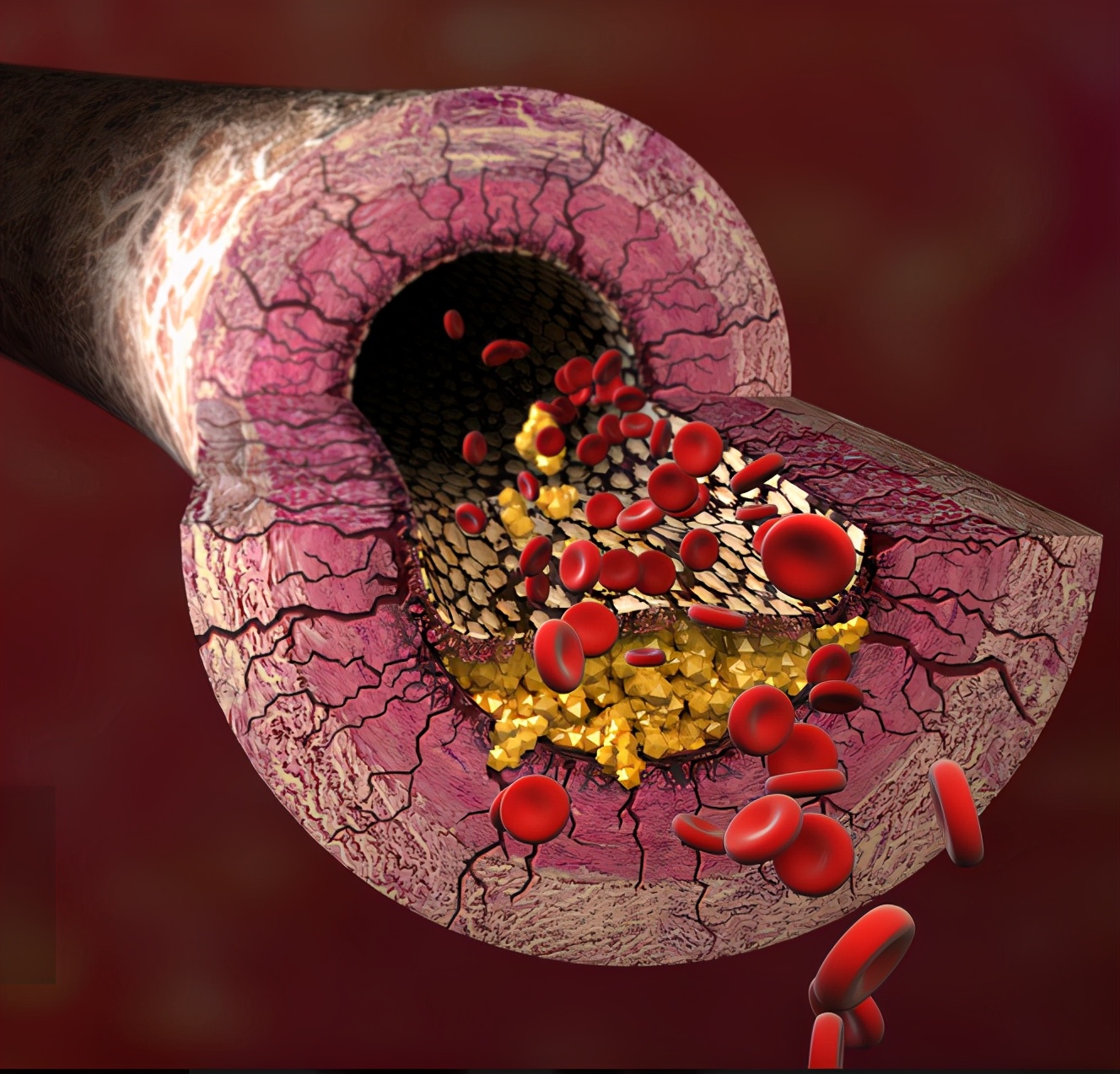 50岁后的人,保持"1软,2通,3小",身体健康,长命百岁|蒲公英|肝脏|肠道
