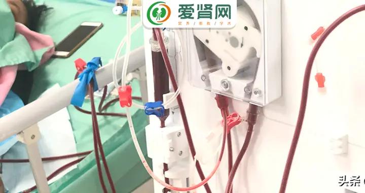每个月做几次灌流和血滤好?肾友该如何选择透析方式?|高血压|血液透析|血液净化|通量|分子_新浪新闻