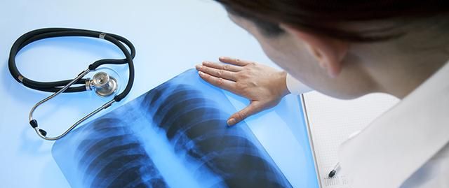 吸烟会诱发肺癌,但从不吸烟的人为什么也会得肺癌?原因有这几点休闲区蓝鸢梦想 - Www.slyday.coM 吸烟会诱发肺癌,但从不吸烟的人为什么也会得肺癌?原因有这几点休闲区蓝鸢梦想 - Www.slyday.coM