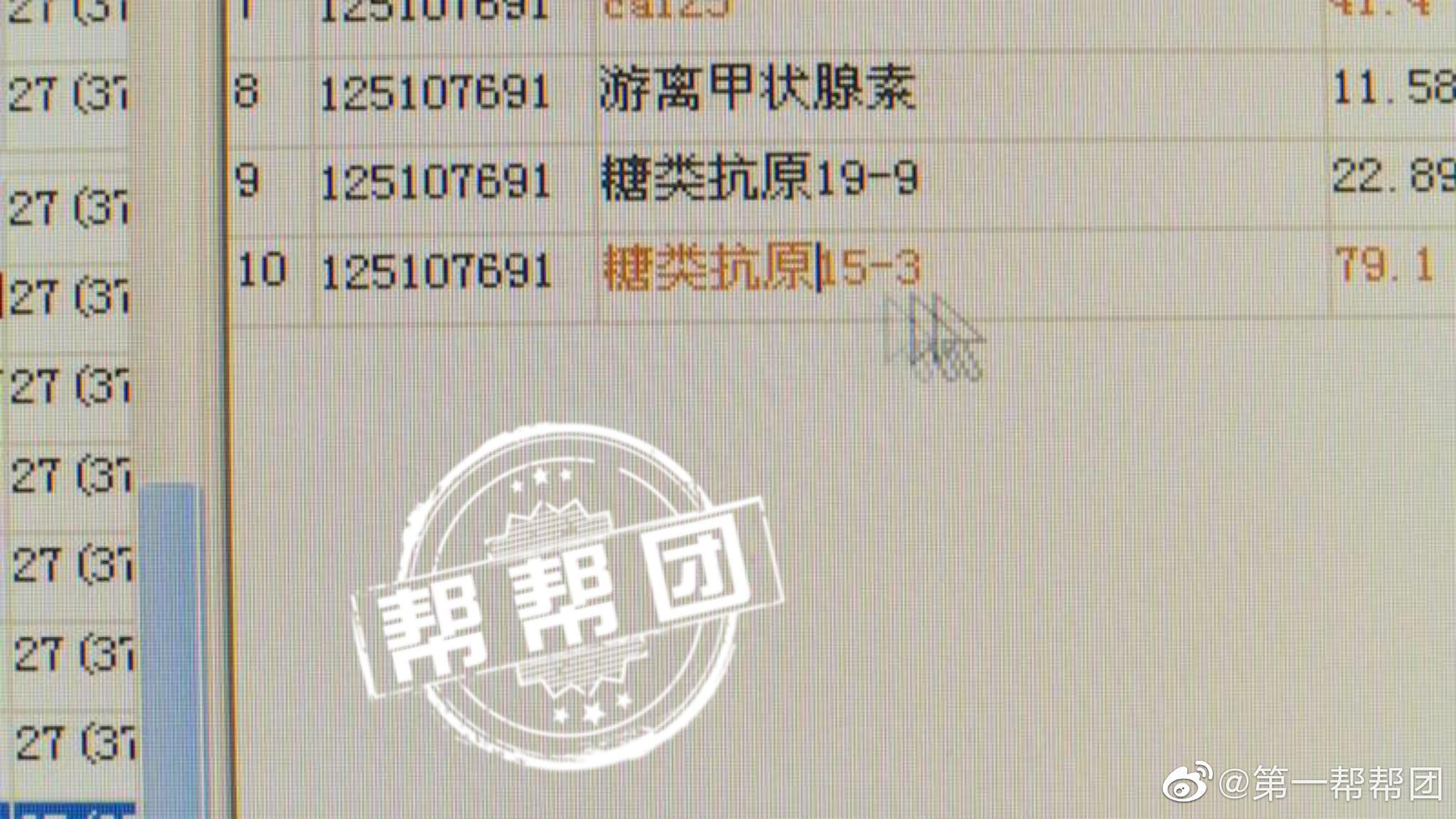 女子突发腿脚不灵,一查竟是恶性肿瘤前奏休闲区蓝鸢梦想 - Www.slyday.coM 女子突发腿脚不灵,一查竟是恶性肿瘤前奏休闲区蓝鸢梦想 - Www.slyday.coM