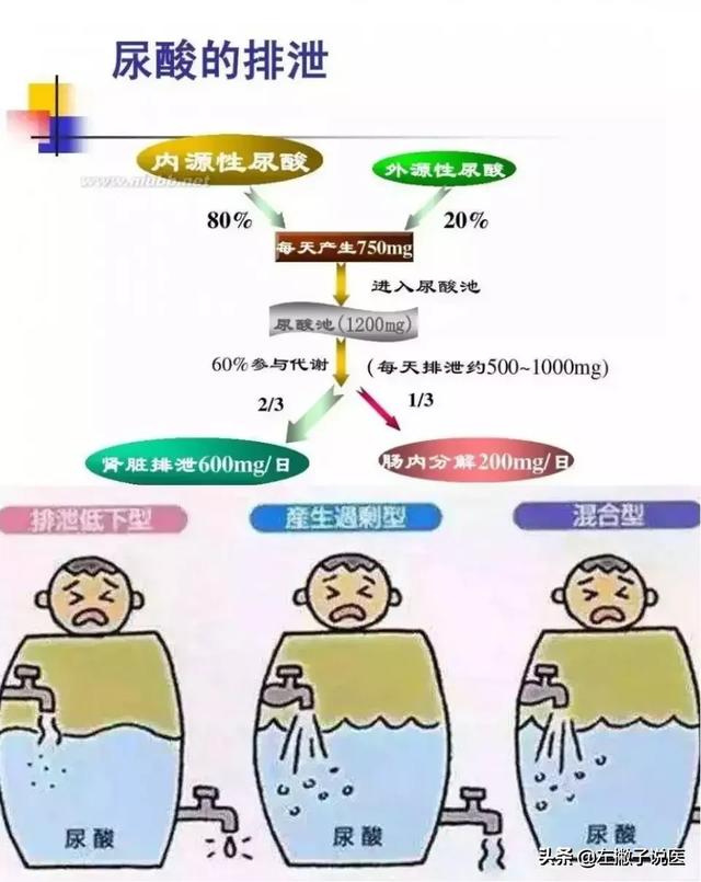 原因,一是由于血液中的尿酸生成过多所致,二是由于尿酸排泄出现了障碍